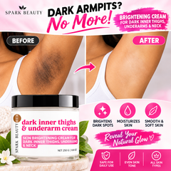 Dark Inner Thighs & Underarm Cream
